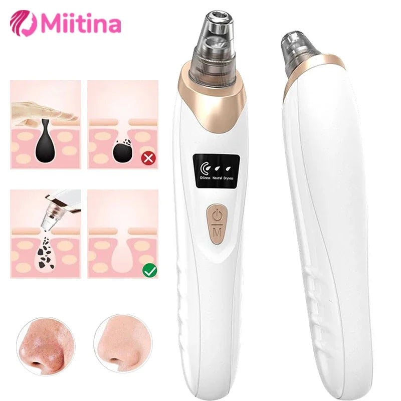 Electric Blackhead Remover with Vacuum Suction - USB Facial Pore Cleaner for Acne and Pimple Extraction