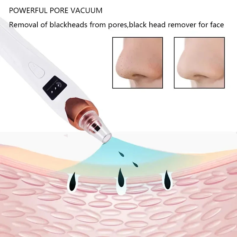 Electric Blackhead Remover with Vacuum Suction - USB Facial Pore Cleaner for Acne and Pimple Extraction