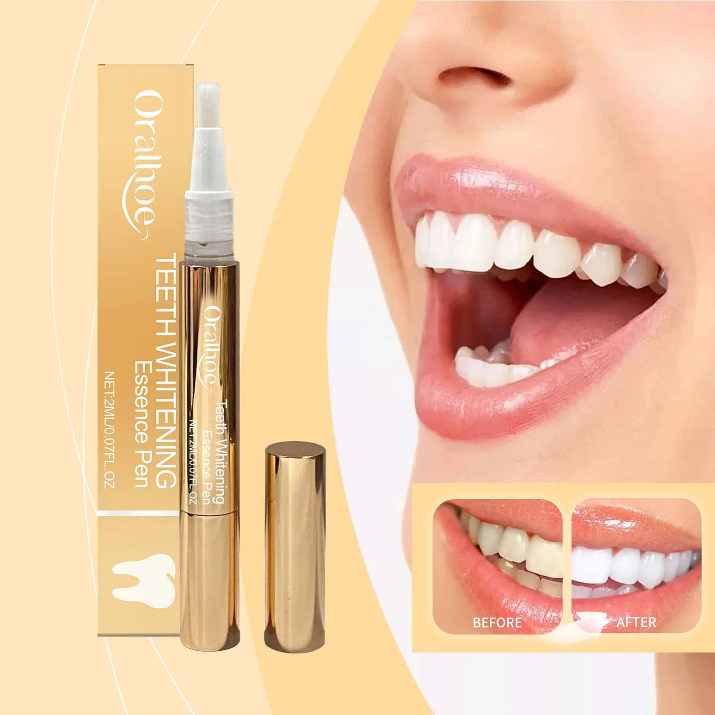 Teeth Whitening Essence Pen for Plaque and Tartar Removal, Dental Hygiene Maintenance, and Fresh Breath Preservation