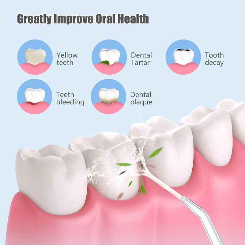 Advanced Waterproof Oral Irrigator with Ultrasound Technology for Effective Dental Care