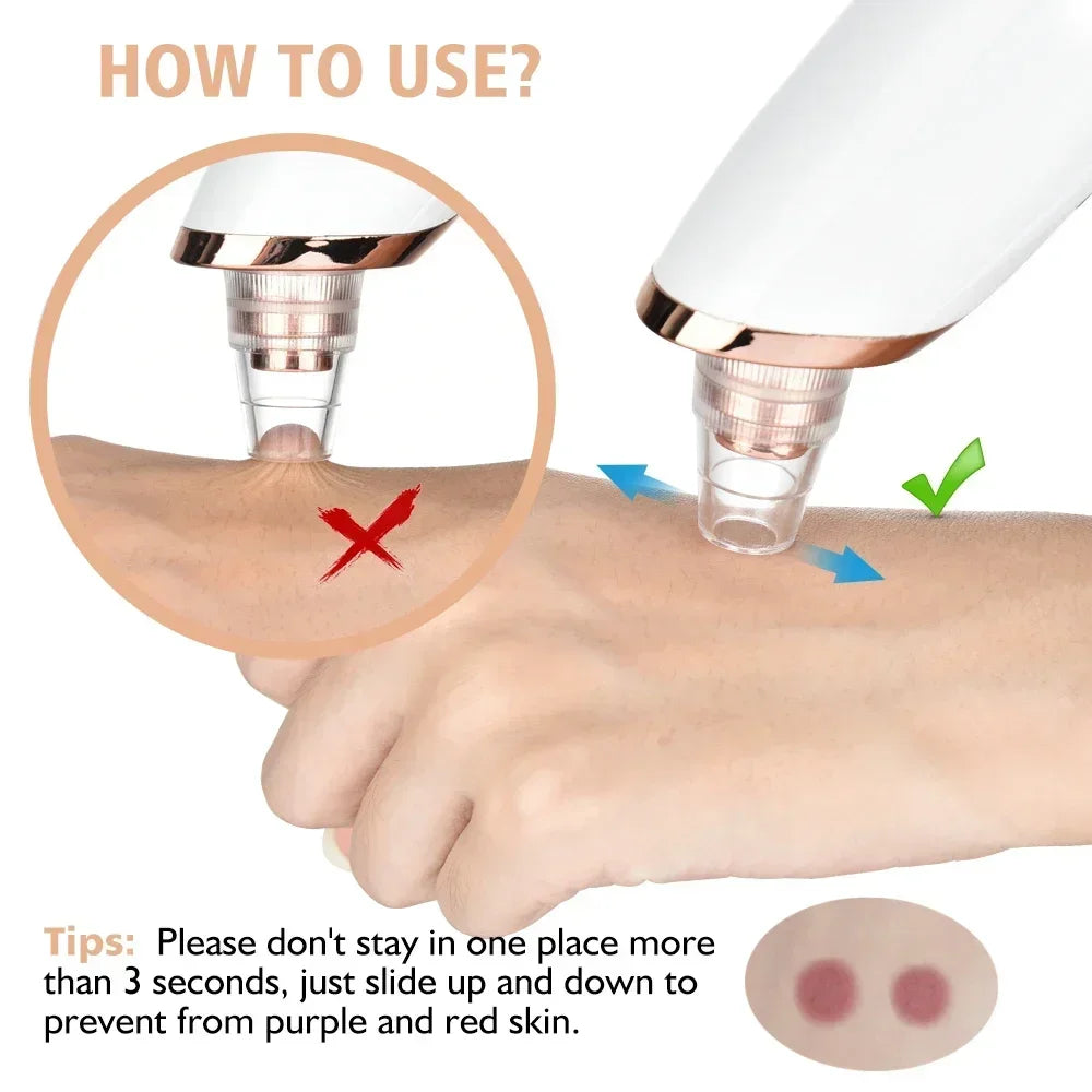 Electric Blackhead Remover with Vacuum Suction - USB Facial Pore Cleaner for Acne and Pimple Extraction