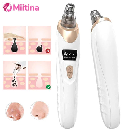 Electric Blackhead Remover with Vacuum Suction - USB Facial Pore Cleaner for Acne and Pimple Extraction