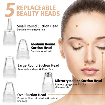 Electric Blackhead Remover with Vacuum Suction - USB Facial Pore Cleaner for Acne and Pimple Extraction